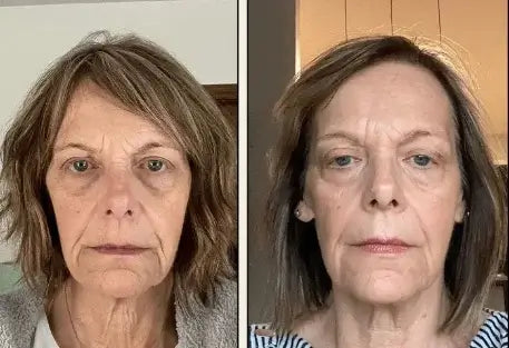 ™Sculpt - כוסות פיסול הפנים מבית Cocon